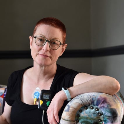 British forensic psychiatrist Jenny Judge, who has been dealing with post-coronavirus symptoms, wears a heart monitor at her home. Photo: Glyn Kirk/AFP