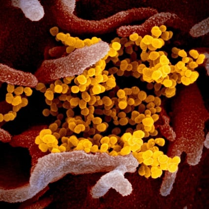 An electron microscope image shows the new coronavirus in yellow, emerging from the surface of cells. The virus is believed to have passed into humans from bats, possibly through an intermediary animal. Photo: EPA-EFE