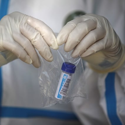 Studies suggest previous exposure to common cold coronaviruses could help people fight Covid-19. Photo: EPA-EFE