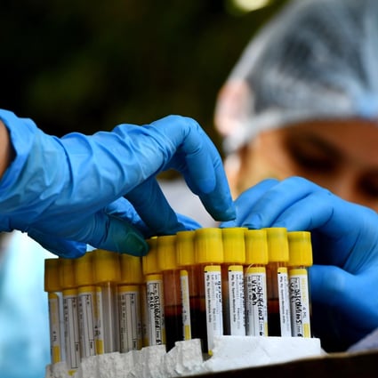 Indian health workers arrange blood samples for testing. Photo: Xinhua