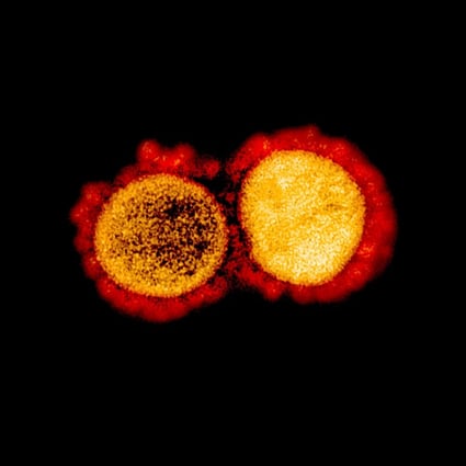 The China Metallurgical Group Corporation warned PNG authorities that 48 staff who returned from China this month may test positive for the virus because they had received a vaccine. This image courtesy of the National Institute of Allergy and Infectious Diseases, shows a transmission electron micrograph of Sars-CoV-2 virus particles, isolated from a patient. Photo: AFP