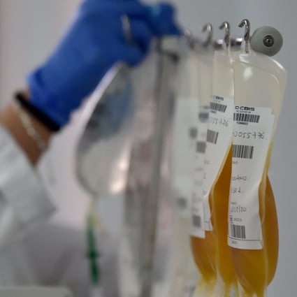 A health worker checks the plasma donated by a recovered Covid-19 patient in Bogota, Colombia on August 12. Photo: AFP