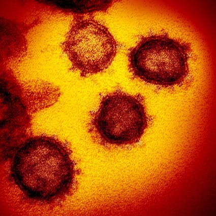 SARS-CoV-2 – also known as 2019-nCoV, the virus that causes Covid-19, Photo: EPA –