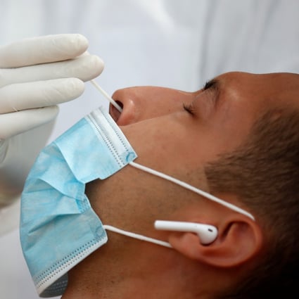 Goodbye Nasal Swabs Saliva Tests Can Detect Coronavirus Infection Studies Show South China Morning Post
