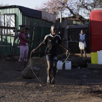 A child skips with a rope outside shacks in the Katlehong Township near Johannesburg. Studies suggest South Africans may have developed immunity to coronavirus. Picture: AP Photo