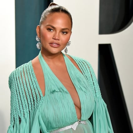 Chrissy Teigen underwent breast reduction surgery in June to remove implants that she’d had for almost 15 years. Photo: Getty Images