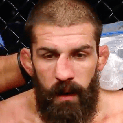 UFC veteran Court McGee’s nose is out of shape during his fight against Carlos Condit at UFC Fight Night in Dubai. Photo: Twitter/Court McGee