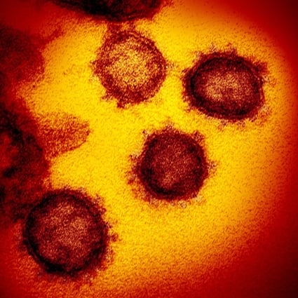 A electron microscope image of SARS-CoV-2, the virus that causes Covid-19. Photo: EPA