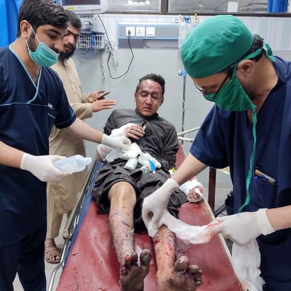 An injured man medical care at a hospital in Peshawar on October 27, 2020. Photo: EPA-EFE