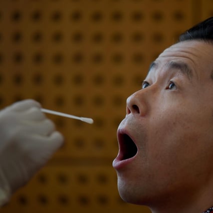 A Chinese citizen undergoes a swab test for the Covid-19 coronavirus. Genscript Biotech has developed a rapid test kit that can detect neutralising antibodies in a person and can be completed in an hour. Photo: AFP