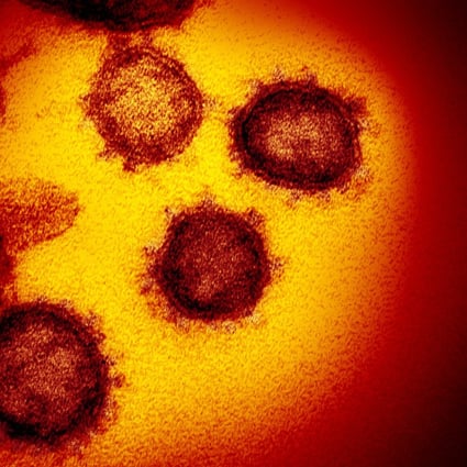 An electron microscope image of the new coronavirus which causes Covid-19. Photo: AP