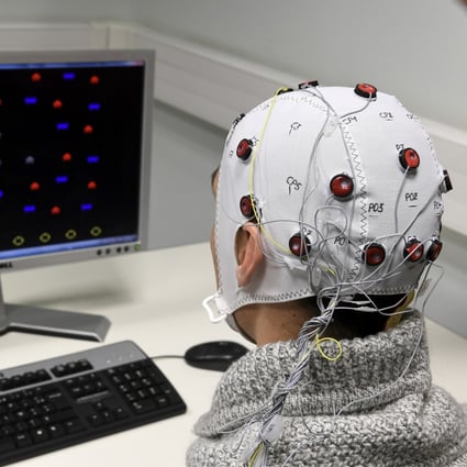 A researcher at CNRS in Grenoble demonstrates a brain-computer interface helmet in this file photo from 2017. In the same year, Shanghai’s Ruijing Hospital used electrode implantation therapy to treat a 45-year-old man with depression. Photo: AFP