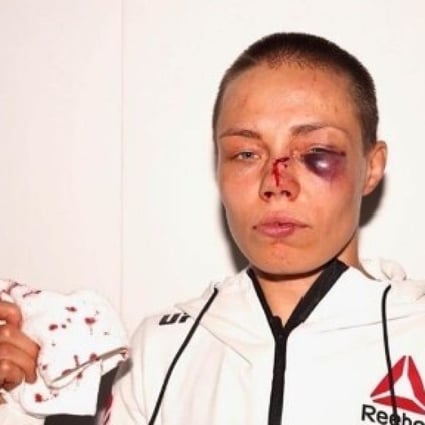 Former UFC strawweight champion Rose Namajunas after her fight with Jessica Andrade at UFC 251 at Fight Island, Abu Dhabi in July. Photo: Instagram/Rose Namajunas