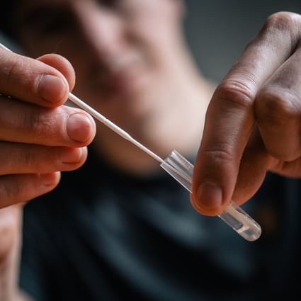 A man holds a swab and tube used for nasal testing. Some Japanese employees in China have called coronavirus tests using anal swabs an action that would humiliate people. Photo: DPA