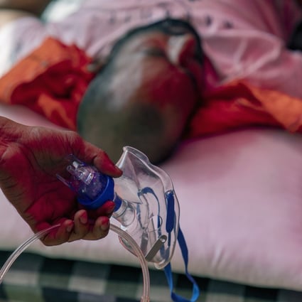 A lack of oxygen and hospital beds have created desperate circumstances in India, the world’s latest epicentre of the Covid-19 pandemic. Photo: Bloomberg