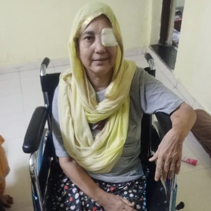 The Black Fungus Nightmare Facing India S Coronavirus Patients South China Morning Post The Black Fungus Nightmare Facing India S Coronavirus Patients South China Morning Post