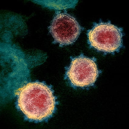 An electron microscope image shows the coronavirus that causes Covid-19. Scientists are trying to create a “pan-coronavirus” vaccine. Photo: AP