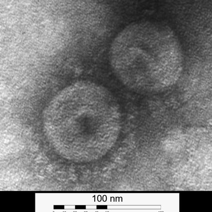 An electron microscope image of CCov-HuPn-2018, the new canine coronavirus that could infect humans found in a pneumonia patient in Sarawak, Malaysia, in 2018. Image: Molecular & Cellular Imaging Centre of the Ohio Agricultural Research and Development Centre, Ohio State University