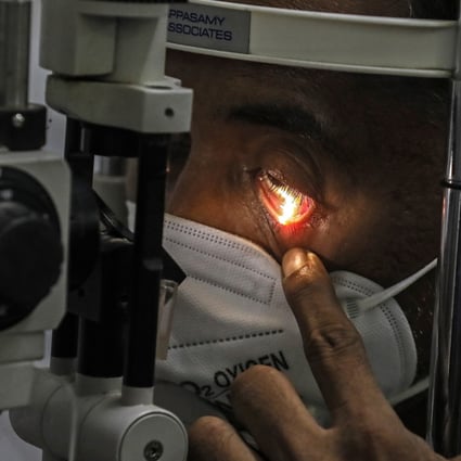 A suspected mucormycosis patient is examined at a hospital in Navi Mumbai, India, on May 25. Mucormycosis, also known as black fungus, appears to be spreading among Covid-19 patients in India. Photo: EPA-EFE