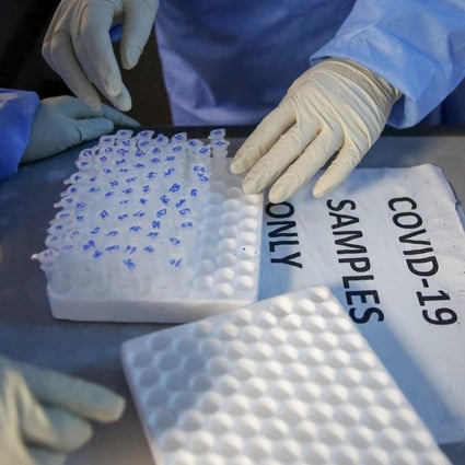Scientists only spotted the woman’s case because she was enrolled in a study on people with HIV looking at their immune response to Covid-19. File photo: AP