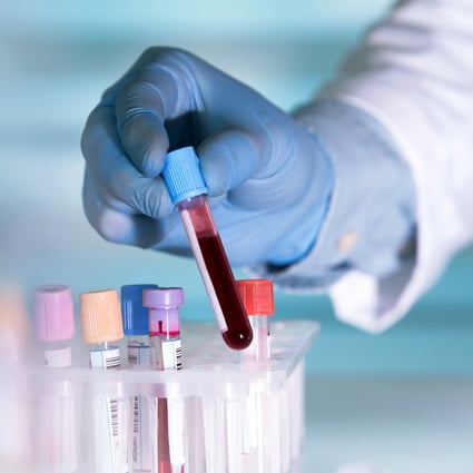 Serological studies have been used in a number of countries to look for evidence of earlier Covid-19 circulation. Photo: Shutterstock