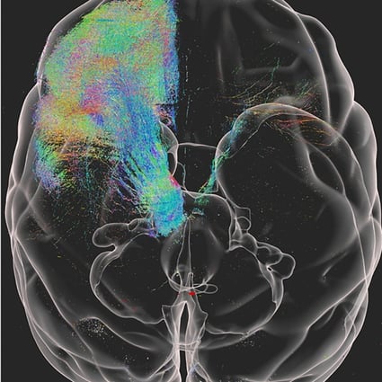 Examples of a monkey’s brain structure captured by the high-resolution image. Photo: Handout
