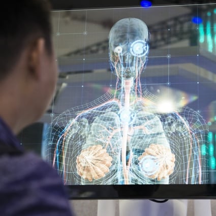 Diagnosis system powered by artificial intelligence (AI) on display during the World Artificial Intelligence Conference in Shanghai on September 17, 2018. Photo: Zigor Aldama/Post Magazine