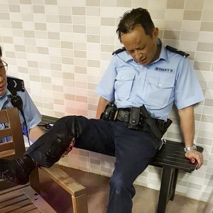 A part-time Hong Kong police officer is treated after being bitten by a wild boar in Hong Kong’s Tin Hau neighbourhood early on Wednesday morning. Photo: Facebook