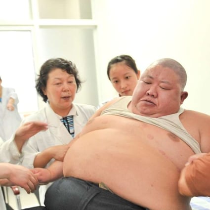 Obesity is among the factors behind an explosion in diabetes cases in China since 1980. Photo: Xinhua