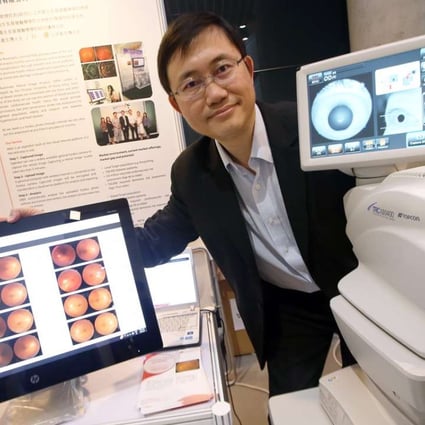 Professor Benny Zee demonstrates how the imaging system works. Photo: David Wong