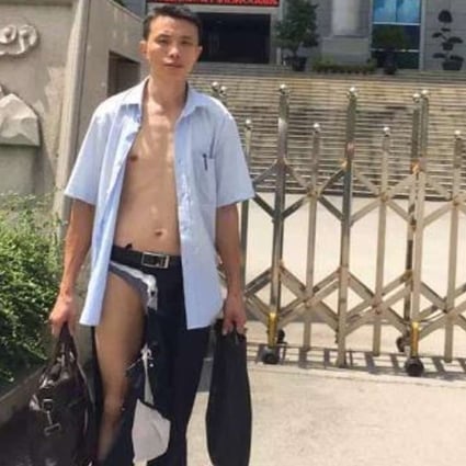 Wu Liangshu pictured after the assault in Nanning. Photo: Caixin