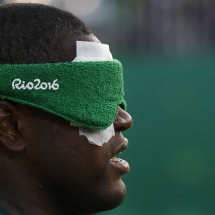 Brazil’s Jeferson da Conceicao Goncalves has lit up the Paralympics soccer competition in Rio. Photo: AP