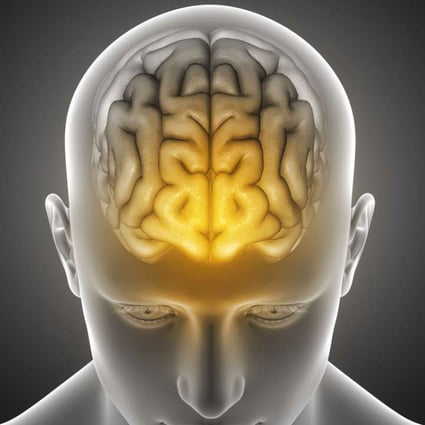 East Asian brains are generally bigger than European or African ones. Photo: Shutterstock