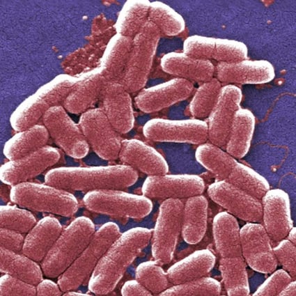 An antibiotic-resistant strain of the E. coli bacteria. Photo: Centres for Disease Control