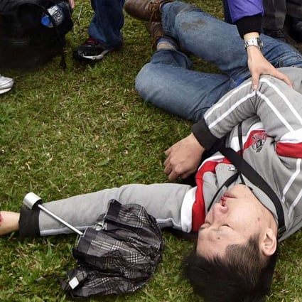 An injured man lies on the ground after clashes between pro-independence and pro-unification groups during the 70th anniversary of the 228 incident at the Chiang Kai-shek Memorial Hall in Taipei on Tuesday. Photo: AFP