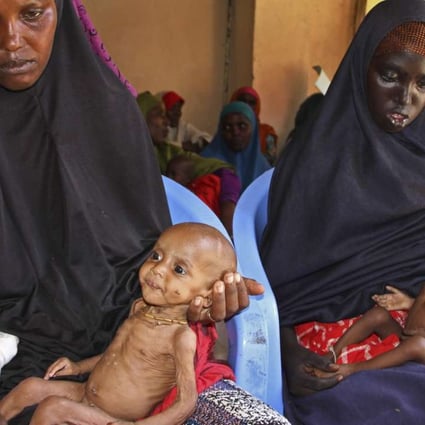 Malnourished baby Ali Hassan, 9-months-old, left, is held by his mother Fadumo Abdi Ibrahim, as mother Habiba Mohamed Aden holds her baby Mohamud Ahmed, 6-months-old, right, all of whom fled the drought in southern Somalia, at a feeding centre in a camp in Mogadishu, Somalia. Photo: AP