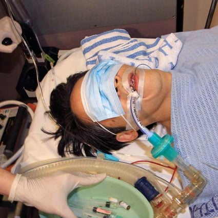 Former Ming Pao chief editor Kevin Lau was the victim of a knife attack in 2014.