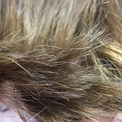 Is Cutting Your Hair The Only Way To Get Rid Of Split Ends South China Morning Post Learn how to heal split ends by applying one of these strengthening and moisturizing hair masks once a week to nourish healthy hair and heal split ends. get rid of split ends