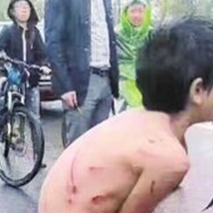 A video of a naked boy covered in welts and being pulled through the streets on the end of a rope attached to his father’s motorbike has sparked outrage online. Photo: Handout