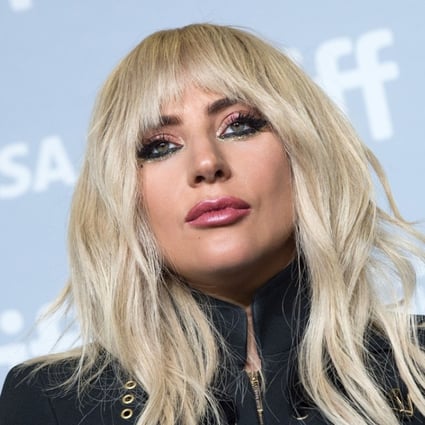 Singer Lady Gaga attends the press conference for “Gaga: Five Foot Two” during the 2017 Toronto International Film Festival. The singer has been hospitalised and is cancelling her concert in Brazil. Photo: AFP