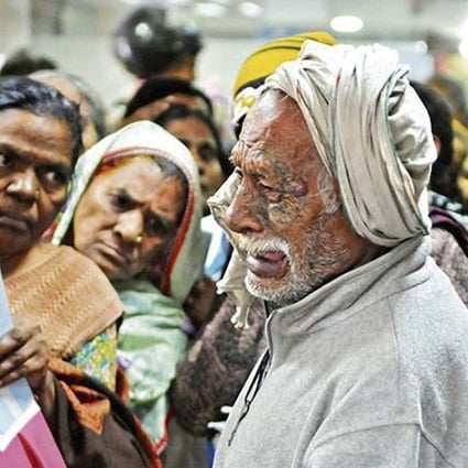 This image of Nand Lal, crying after losing his spot in a bank queue, became emblematic of the havoc caused by Indian Prime Minister Narendra Modi’s note ban. Photo: Twitter