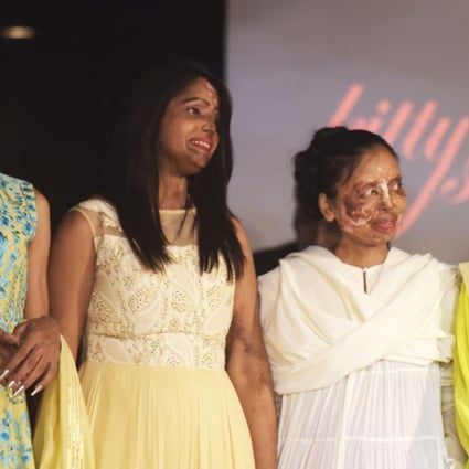 Indian acid attack survivors pose at the end of the fashion show organised by the ‘Make Love Not Scars’ NGO in New Delhi. Photo: AFP