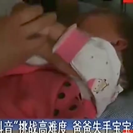 The toddler injured in the accident. Photo: News.163.com