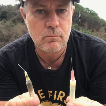 Beach clean-up organiser Robert Lockyer with syringes found at Pak Kok Tsui, Lamma Island. 