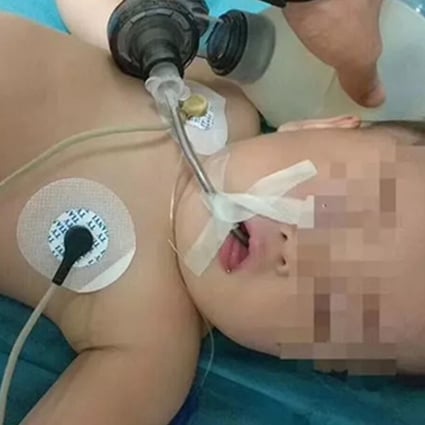 The one-year-old was revived with CPR and is being treated in intensive care. Photo: Changanhome.com