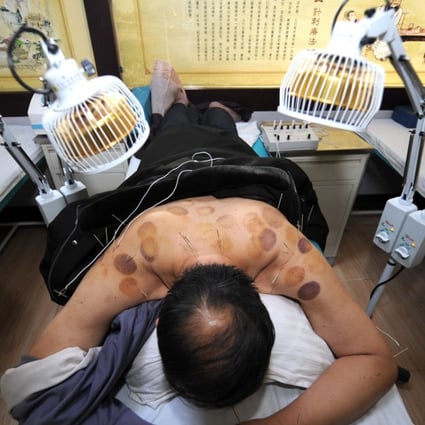 A man receives acupuncture treatment at a hospital in Wuwei, northwest China’s Gansu province. Photo: Xinhua