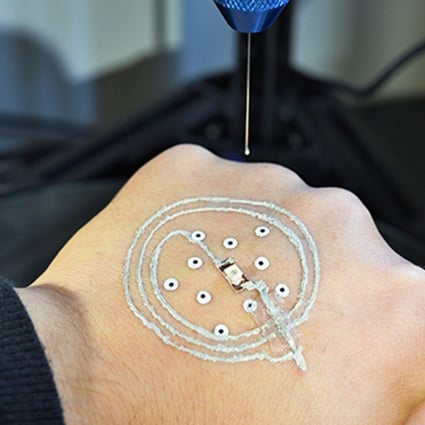 New 3D-printing techniques on skin use computer vision to track and adjust to movements in real-time. Photo: McAlpine group, University of Minnesota