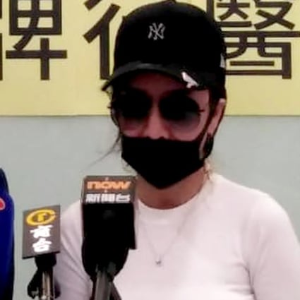 My Botched HK 80 000 Nose Job Was Done By Doctor With No Medical 