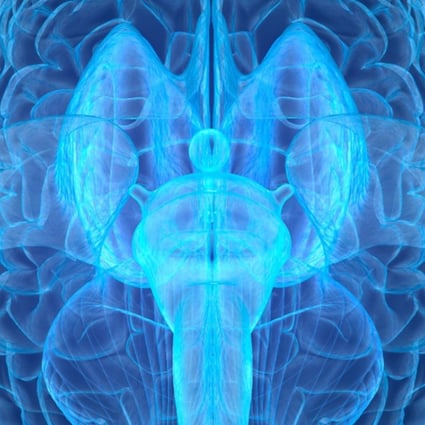 Chinese scientists are developing the world’s most powerful brain scanner. Photo: Alamy