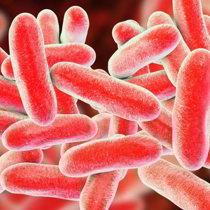 Legionnaires Disease In Hong Kong What Is It Who Is At Risk And How Do We Prevent It South China Morning Post